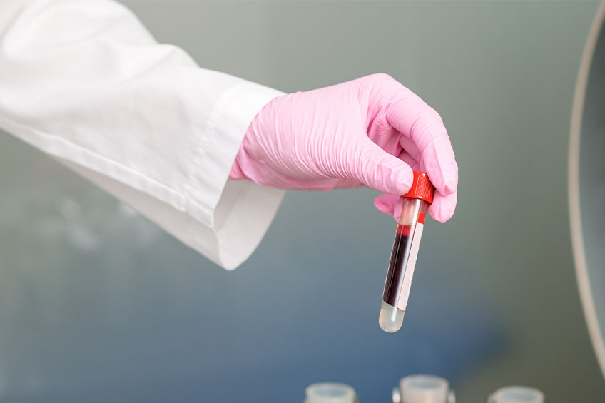 Illustrative example of pink gloves from Google Search